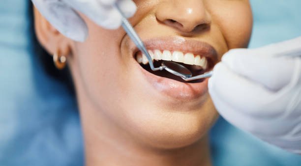 Best Dental Abscess Treatment in Great Falls, VA