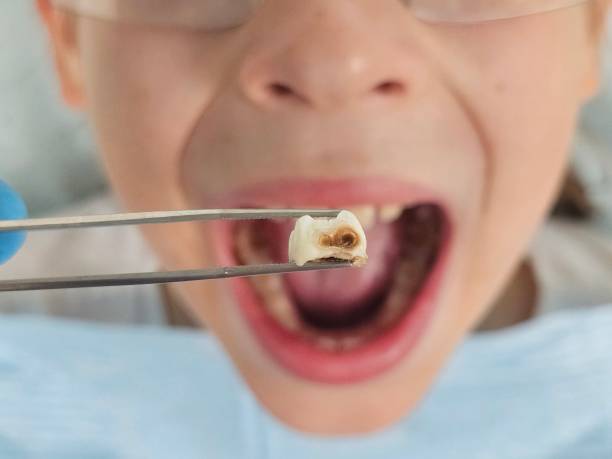 Best Emergency Pediatric Dental Care in Great Falls, VA